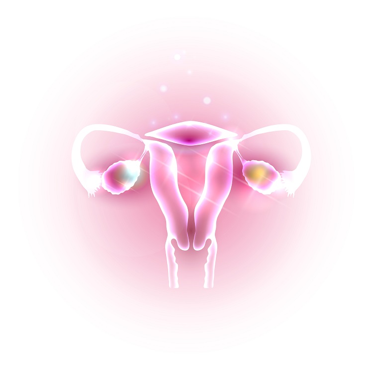 Polycystic Ovary Syndrome